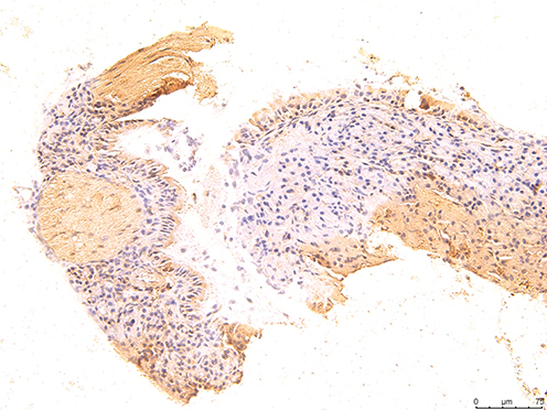Figure 11 The immunohistochemical staining results of the day 24 group were observed under 200X microscope.