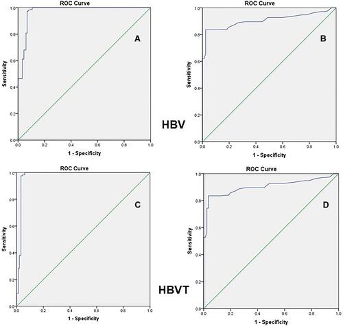 Figure 1 The receiver operating characteristic (ROC) curve for glutamine (GLN) and nitrotyrosine (NT) detection of HBV infection according to positive DNA testing in the patient groups: (A) GLU-HBV, (B) NT-HBV, (C) GLU-HBVT, and (D) NT-HBVT.