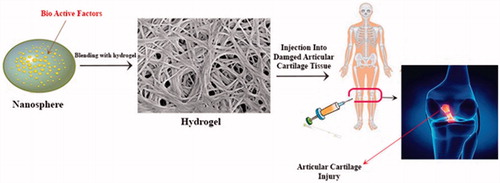 Figure 1. Hydrogels can be used as injectable scaffolds because they simply fill defects with any shape and size.