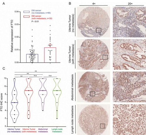 Figure 1. FTO is overexpressed in metastatic EC cancer. (A) FTO mRNA expression in metastatic EC (N = 30) and nonmetastatic EC tissues (N = 66). (B) Expression of the FTO protein in nonmetastatic EC tissue and different types of metastatic EC tissues. (C) The IHC score of the FTO protein in different EC samples, (No metastasis, N = 66), (With metastasis, N = 30), (Abdominal metastasis, N = 24), (Lymph node metastasis, N = 22). **P < 0.01, n.s indicates not significant