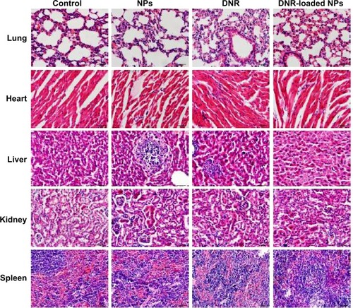 Figure 7 Histopathologic examination to determine the toxicity of therapeutic drugs on lungs, hearts, livers, kidneys, and spleens at the end of the experiments (H&E ×400).Abbreviations: DNR, daunorubicin; NPs, nanoparticles; H&E, hematoxylin and eosin stain.