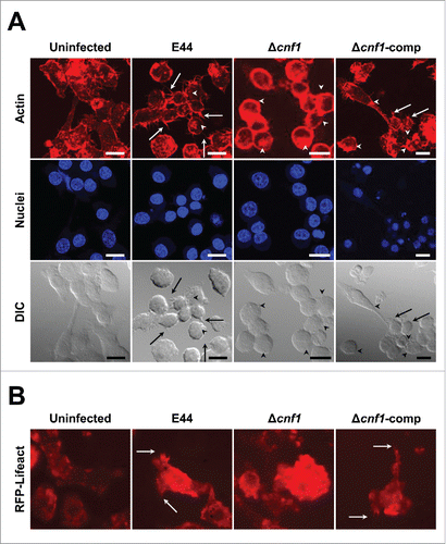 Figure 2. E. coli K1 expressing CNF1 induces microspikes in macrophages. (A) RAW 264.7 macrophages were infected with bacteria and stained for actin. The nucleus was stained with DAPI. Arrows indicate microspikes and arrowheads indicate bacterial attachment sites or actin accumulation. The brightness was adjusted to the same degree in all images to clearly show the microspikes. The number of cells with microspikes as a fraction of total cells in these particular fields of view: Uninfected (2/12); E44 (10/15); Δcnf1 (4/14), Δcnf1-comp (8/13). Scale bars = 15 µm. (B) BMDMs isolated from RFP-Lifeact mice were infected as above and videos obtained. A screenshot of a single representative field of view is shown to demonstrate actin dynamics. Arrows indicate microspikes. The corresponding videos are provided in Supplementary Figure S1.