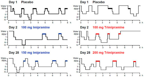 Figure 2 Changes in hypnograms during treatment of depression with trimipramine or imipramine. Imipramine, but not trimipramine, suppresses REM sleep.