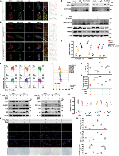 Figure 3. NLRX1 is essential for the beneficial action of mitophagy in alleviating mitochondrial dysfunction and NP cell senescence. Primary human NP cells isolated from NP tissues with different Pfirrmann grades were prepared. (A) confocal analysis of NLRX1 and MAP1LC3B with if staining in NP cells isolated from health NP tissues treated by PBS or TBHP, scale bar: 10 μm. (B) proteins immunoprecipitated (IP) from NP cells isolated from health NP tissues treated by PBS or TBHP followed by western blotting, left panel: IP with anti-MAP1LC3B antibody, right panel: IP with anti-NLRX1 antibody. (C) confocal analysis of TOMM20 and MAP1LC3B with if staining in NP cells isolated from degenerated NP tissues treated by PBS or TBHP with NLRX1 overexpression or not, scale bar: 10 μm. (D and E) protein expressions of mitophagy indicators (MAP1LC3B-II, TOMM20, TIMM23) in primary human NP cells isolated from degenerated NP tissues treated by PBS or TBHP with NLRX1 overexpression or not, as determined by western blotting. (F-I) JC-1 incubation for detecting mitochondrial membrane potential (MMP; F, H) and DCFH incubation for detecting reactive oxidative species (ROS; G, I) in NP cells isolated from degenerated NP tissues treated by PBS, TBHP or 3-MA with NLRX1 overexpression or not, as determined by flow cytometry. (J and K) protein expressions of senescence indicators (TP53, CDKN2A) and SASP factors (IL1B, IL6) in NP cells isolated from degenerated NP tissues treated by PBS, TBHP or 3-MA with NLRX1 overexpression or not, as determined by western blotting. (L and M) cell proliferation (MKI67 immunofluorescent staining, EdU incorporation) and cell senescence (SA-GLB1/β-gal staining) in primary human NP cells isolated from degenerated NP tissues treated by PBS, TBHP or 3-MA with NLRX1 overexpression or not, scale bar: 50 μm (IF images), 100 μm (white light images). Data are represented as mean ± SD. *p < 0.05, **p < 0.01.