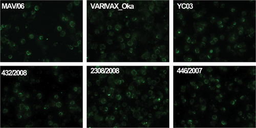 Figure 1. Image of FAMA test with positive reference serum using six different VZV strains as FAMA antigens (400× magnification).