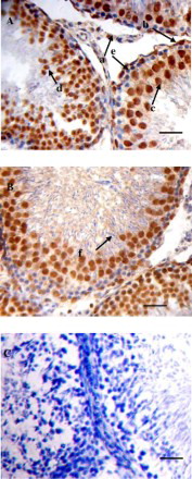 Figure 3.  Histological observation of rat testis tissue by immunolocalization of GHS-R1a protein. (A) Testis: Leydig cells (arrow a), Sertoli cells (arrow b), primary spermatocytes (arrow c), secondary spermatocytes (arrow d), and spermatogonia (arrow e). (B) Testis: spermatids (arrow f). (C) negative control reaction carried out after substitution of PBS. A, B, C, Scale bar = 25 μm.