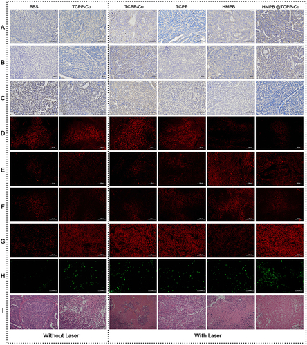 Figure 5 Representative images of stained tumor tissue sections of nude mice after treatment in each experimental group. Each set of images was stained for (A) caspase-3, (B) caspase-9, (C) PCNA, (D) HIF-1α, (E) HSP70, (F) HSP90, (G) ROS, (H) TUNEL assay, and (I) HE.