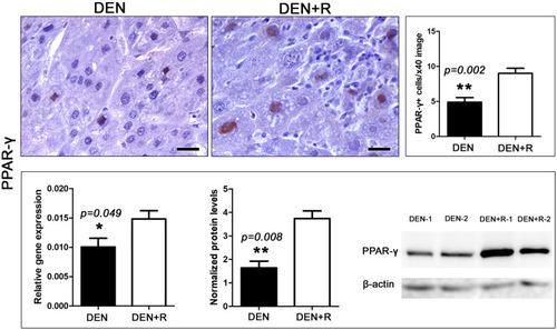 Figure 4 HDAC1/2 blockade affects PPAR-γ expression. The anti-tumor treatment significantly increased the number of HCC cells with positive nuclear PPAR-γexpression immunohistochemical signal. This result is line with PPAR-γgene and protein expression analysis as assessed by Real-time PCR and Western Blot analysis, respectively. Western Blot from two selected liver samples per experimental group, also used in Figure 3, is shown. IHC; Diaminobenzidine chromogen, Hematoxylin counterstain. Scale bars: 25 μm. Numbers on the y-axis of bar graphs correspond to the mean±SEM of the parameters assessed. *p<0.05, ** p<0.001.Abbreviations: DEN, diethylnitrosamine; PPAR-γ, peroxisome-proliferator-activated receptor gamma; R, Romidepsin.