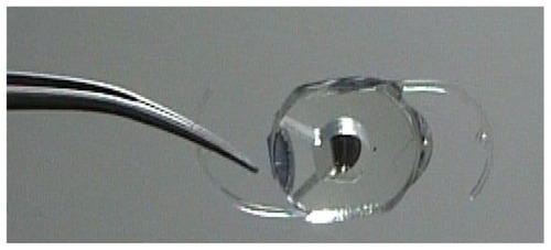 Figure 3 Lipshitz Mirror implant (LMI; Optolight Vision Technology, Herzlia, Israel).Citation22