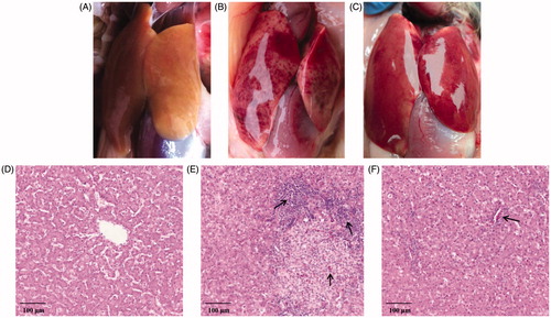 Figure 2. The pathological change of the liver in each group. A, visual pathological changes of blank control; B, visual pathological changes of virus control; C,visual pathological changes of BLIN treating; D, H&E staining (200×) of blank control; E, H&E staining (200×) of virus control; F, H&E staining (200×) of BLIN treating.