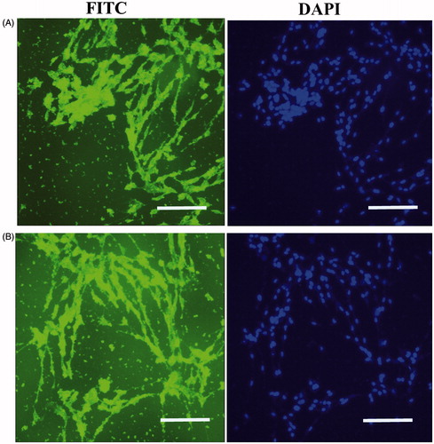 Figure 5. In vitro expression analysis of collagen II and aggrecan markers on the scaffold free method after 21 d. Type II collagen (A), and aggreacan (B), scale bars are 100 μm. Staining of nucleus was performed by DAPI (blue), scale bars are 100 μm.