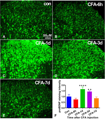 Figure 1 Expression of proBDNF in the spinal cord after CFA intraplantar injection. (A–E) The immunofluorescence staining of proBDNF in the ipsilateral spinal cord at different time points (6 h, 1 d, 3 d, and 7d) after CFA injection. Scale bars= 50 µm. (F) Quantification of proBDNF expression in the ipsilateral spinal cord at different time points (6 h, 1 d, 3 d, and 7d) after CFA injection. Data are presented as the mean ± SD, n = 5. **P < 0.01, ****P < 0.001 compared with control group at the corresponding time point.