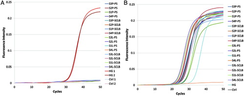 Figure S1.  PCR assessment of DNA contamination and RNA integrity. A. Isolated RNAs and two human genomic cDNA samples were used as template. B. The synthesized cDNAs were used as template. The primer pair spans the PRM1 intron. S1∼S4 are the samples from four subjects; ‘P’ denotes pelleted storage. ‘L’ denotes liquefied storage; PS denotes PureSperm purification and SCLB is somatic cell lysis buffer purification; HG denotes human genome DNA; Ctrl denotes negative control.