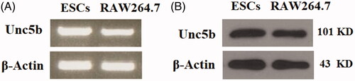 Figure 1. UNC5b is expressed in epidermal stem cells (ESCs). (A) RT-PCR analysis revealed that UNC5b is expressed in ESCs; (B) Western blot analysis revealed that UNC5b is expressed in ESCs. RAW264.7 cells were used as a positive control. Experiments were performed in triplicate.