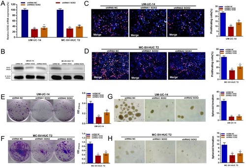 Figure 3 Effect of SOX2 on the proliferation and stemness of UTUC cells. (A and B): SOX2-specific shRNAs significantly decreased the expression level of SOX2 in UM-UC-14 and MC-SV-HUC T2 cells. (C and D): Cell proliferation changes in UTUC cells were determined using an EdU assay. (E and F): Cell proliferation changes in UTUC cells were determined using a colony-formation assay. (G and H): The cell stemness of UTUC cells was determined using a sphere-forming assay. Cell proliferation was inhibited by silencing SOX2 in UM-UC-14 and MC-SV-HUC T2 cells. Data are shown as the mean ± SD. **p < 0.01.