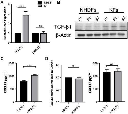 Figure 3 TGF-β1 increased extracellular CXCL12 without inducing CXCL12 expression. (A) Detection of TGF-β1 and CXCL12 expression in NHDFs (n=3) and KFs (n=3) by real-time PCR analyses. (B) Western blot analyses of TGF-β1 in NHDFs (n=3) and KFs (n=3). (C) Expression of CXCL12 in the cell supernatant of NHDFs (n=3) after TGF-β1 treatment (10ng/mL) was measured by ELISA. (D) Expression of CXCL12 in the cell lysate of NHDFs (n=3) after TGF-β1 treatment (10ng/mL) was measured by real-time PCR and ELISA; ns= P>0.05, ***P < 0.001. ns= P>0.05, ***P < 0.001.
