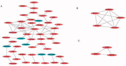 Figure 3. PPI network and the most significant module of DEGs of four endometriosis datasets. (A) The PPI network of DEGs was constructed using Cytoscape. (B, C) The most significant module was obtained by MCODE.