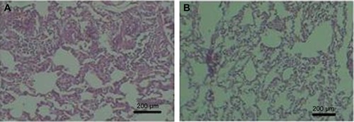 Figure 9 Histology of lung tissue.