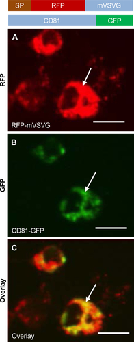 Figure S1 Colocalization of mVSVG with exosome marker CD81 in HEK293 cells.Notes: Cultured cells were cotransfected with RFP-mVSVG and exosome marker CD81-GFP for 3 days. Cell images of the same field were taken to show the expression and subcellular localization of mVSVG (A, red), CD81 (B, green), and colocalization of both (C, yellow). Arrows indicate endosome/exosome/MVB structures. Scale bar 20 µm.Abbreviations: VSVG, vesicular stomatitis virus glycoprotein; mVSVG, minimal VSVG; MVB, multiple-vesicle body; SP, signal peptide.