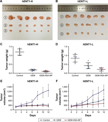 Figure 5 Tumor weights and volume profiles in hENT1-H and hENT1-L group.Notes: (A) Tumors harvested from each subgroup after different treatments in the hENT1-H group. (B) Tumors harvested from each subgroup after different treatments in the hENT1-L group. (C) Tumor weights of each subgroup in the hENT1-H group. (D) Tumor weights of each subgroup in the hENT1-L group. (E) Tumor volume profiles of mice treated with NS, GEM and GEM-HSA-NP in the hENT1-H group. (F) Tumor volume profiles of mice treated with NS, GEM and GEM-HSA-NP in the hENT1-L group. NS was used as control. ①, ② and ③ represent NS, GEM and GEM-HSA-NP, respectively.Abbreviations: GEM, gemcitabine; GEM-HSA-NP, gemcitabine-loaded human serum albumin nanoparticle; NS, normal saline; hENT1-H, high hENT1 expression; hENT1-L, low hENT1 expression.