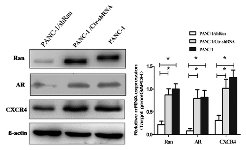 Figure 4. Alteration of gene expression profiling by Ran knockdown in PANC-1 cells. The expression of Ran, AR, and CXCR4 in pancreatic cancer cells was evaluated by western blotting and real-time PCR. β-actin and GAPDH were used as the internal control. *P < 0.05.