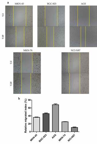 Figure 1. Identification of gastric cancer-derived exosomes. A. The basic migratory ability was assessed on five gastric cancer cell lines with different differentiated degrees using wound healing migration assay. AGS cells had the strongest migratory ability, followed by BGC-823, MKN-45 and MKN-74, NCI-N87 cells was the weakest. B. The relative migrated rate was counted out and significant differences among the five groups were observed (P < 0.001, as shown by Student’s t-test). C. Electron microscopy images of exosomes. The exosomes were characterized as a typical “cup-mouth” structure. D. Western blotting analysis of the exosomes marker proteins. Vesicles isolated from gastric cancer cells were positive for the exosomes markers CD9, CD81 and TSG101. Whereas equal amounts of proteins obtained from the cells were immunoblotted weaker. Galenxin was used as an internal reference. E. Nanosight graph showed that the majority of exosomes were at 97.5 nm (X = particle size, Y = count/mL)