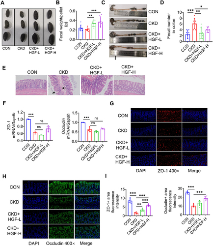 Figure 3 Effects of HGF on the colonic microenvironment in the CKD rats. (A and B) Fecal shape (A), and weight per pellet (B) that was calculated as (total wet weight) / (total numbers), n = 7–8 rats per group. (C and D) Number of residual stools in the colon, n = 7–8 rats per group. (E) Representative images of the colonic tissues using H&E stains (200×). The black arrows indicate injuries. (F) mRNA expression of ZO-1 and Occludin in colon tissues, n = 3 from three independent experiments. (G and H) Representative pictures of expression of ZO-1 and Occludin in colon from immunofluorescence staining (400×). (I) The mean fluorescence intensity of ZO-1 and occludin was quantified by ImageJ software, n = 6 rats per group. Data represent mean ± SD, *P < 0.05, **P < 0.01, and ***P < 0.001.