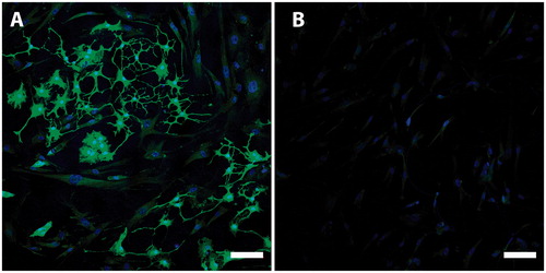 Figure 4. Nestin is a marker of immature and undifferentiated neuroepithelial cells. It has been suggested that nestin expression is a necessity for differentiation into neurons and glia cells. This picture demonstrates different levels of nestin expression in CD271+ (A, green) and CD271- (B, green) populations. Nuclei were counterstained with Hoechst (blue). Scale bar, 100 µm.