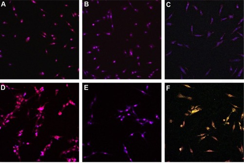 Figure 9 Confocal microscopic images of uptake for normal human osteoblast cells: (A) control, (B) treated with 20 μM of curcumin in phosphate-buffered saline, and (C) treated with 20 μM of curcumin encapsulated by amphiphilic nanoparticles. Confocal microscopic images of uptake for osteosarcoma cells: (D) control, (E) treated with 20 μM of curcumin in phosphate-buffered saline, and (F) treated with 20 μM of curcumin encapsulated by amphiphilic nanoparticles. Images were taken at a magnification of 10×.