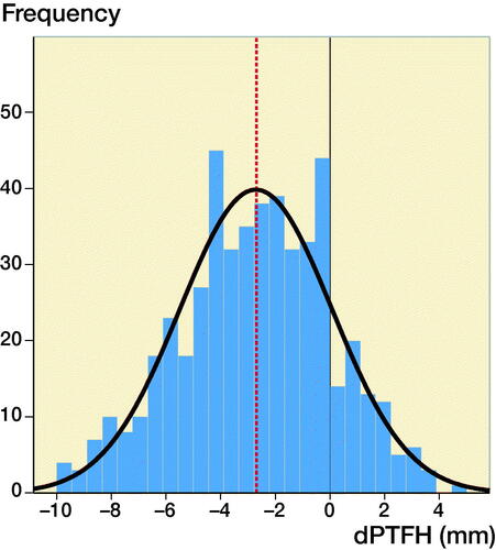 Figure 3. The graph demonstrates a normal distribution of dPTFH measured in 500 legs of children and adolescents from the age of 8–16 years. The mean dPTFH is –2.7 mm with a standard deviation (SD) of 2.8 mm. For clinical practicability mean and SD should be approximated to –3 mm and 3 mm, respectively.