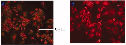 Figure 2. Immunofluorescence of cytokeratin 18 (100×). Note: Bovine mammary epithelial cells (A); Bovine mammary fibroblasts (B).