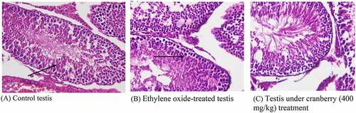 Figure 7. Histopathological examination of the testes of rats before and after treatment with cranberry (scale bar 35 microns with 40x magnification). Photomicrographs of EtO-treated testes indicated edema leading to the separation of the cell lining of the seminiferous tubules, the seizure of spermatogenesis, and focal necrosis