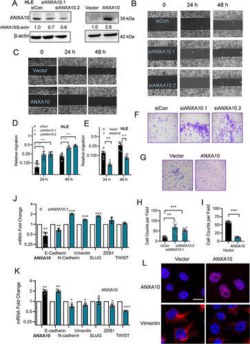 Figure 6 ANXA10 inhibited the migration and invasion with suppressed expression of EMT markers in HCC cells. (A) ANXA10 protein levels in HLE cells transfected with siRNAs against ANXA10 (siANXA10.1 and siANXA10.2) or ANXA10 overexpression plasmid. (B and C) Microscopic fields (10×) from wound healing assays in ANXA10 knockdown or ANXA10 overexpression HLE cells. (D and E) Quantification of (B and C) plotted as mean ± SEM (n=3; **p < 0.01 and ***p < 0.001). (F and G) Matrigel transwell assays (4×) in HLE cells with ANXA10 knockdown or overexpression. (H and I) Quantification of (F) and (G) (n=3; **p < 0.01, and ***p < 0.001). (J and K) Normalized mRNA levels of EMT markers in ANXA10 knockdown or overexpression HLE cells by RT-qPCR (n=3; *p < 0.05, **p < 0.01, and ***p < 0.001). (l) Immunofluorescence of Vimentin in HLE with ANXA10 overexpression (bar=10 μm).