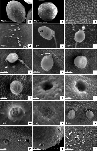 Figure 1. Scanning electron microscopic analysis. (a) Mature egg, lateral view. (b) Mature egg, apical view. (c) Granular protuberance on the surface of mature egg. (d) Sperm binding to the surface of egg. (e) Sperm shape. (f) Acrosomal filament is produced by acrosomal action. (g) Acrosomal filament agley penetrates into the egg envelope. (h) The head of the sperm about to enter the egg. (i) The front of the sperm head embedded in the egg envelope. (j) Sperm head largely penetrated into the egg envelope. (k) Micropyle on the surface of the egg envelope. (l–m) Micropyle filled with fibrin and colloid. (n) The micropyle is blocked. (o) Two sperm penetrating the egg. (p) Single sperm penetrating into the egg near a micropyle. (q) Several sperm penetrating into one egg. (r) Many micropyles remaining beyond polyspermy. AC, acrosome; N, nucleus, M, mitochondria; F, flagellum; AF, acrosomal filament; PP, micropyles left by polyspermy; S, sperm.