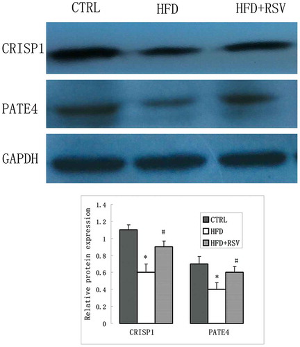 Figure 7. Spermatozoa function-related proteins were detected by Western blot. Representative images of the CTRSP 1, PATE 4 expression in the CTRL, HFD and HFD+RSV groups. The quantification of protein expression levels were presented with normalized to GAPDH levels in right panel. Data were presented as mean ± standard error of the mean (SEM). *P < 0.05 vs. CTRL, #P < 0.05 vs. HFD.