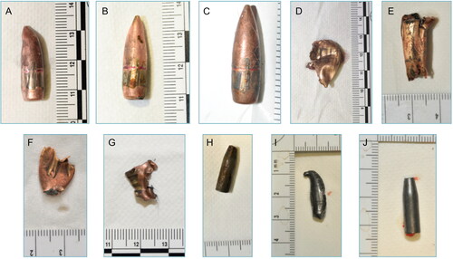 Figure 2. Examples of ballistic material collected from victims' bodies. (A)–(C) Intact or slightly deformed 7.62-mm bullets. (D)–(G)  Jacket fragments. (H)–(J) Steel cores.