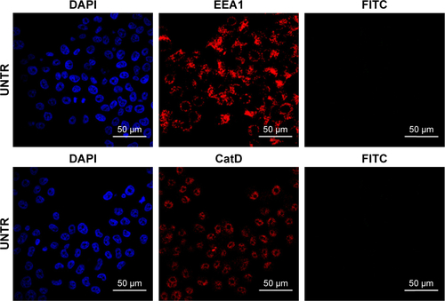 Figure S8 Confocal microscopy.Notes: Confocal microscopy untreated cells labeled with DAPI (nuclei), EEA1 (early endosomes) and CatD (lysosomes). Scale bar =50 µm.Abbreviations: DAPI, 4′,6-diamidin-2-fenilindolo; EEA1, Early Endosome Antigen 1; CatD, Cathepsin D.