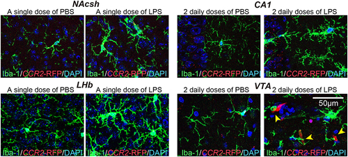 Figure 2 Mild, LPS-induced inflammation does not cause the infiltration of peripheral immune cells. Representative images showing the number of CCR2-RFP+ cells and immunostaining for the microglial marker Iba-1 (green) in the indicated brain regions of CCR2-RFP mice injected with saline or i.p.-administered a single or 2 daily doses of LPS. Yellow arrow heads indicate CCR2-RFP+ cells.
