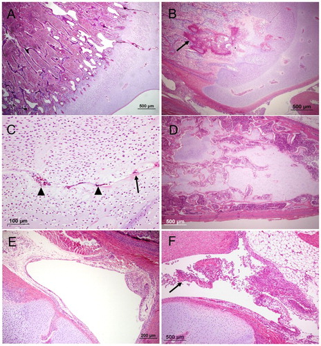 Figure 1. The proximal end of femur or tibiotarsus (haematoxylin and eosin) with different lesions. (A) an example of a typical healthy growth plate; (B), an example of a typical BCO inflammation within the epiphyseal growth plate (arrow); (C), non-artefactual separation at the hypertrophic zone of the growth plate. Note evidence of remodelling at the margins of the cleft (eosinophilic matrix, arrow) and cellular debris within the cleft (arrowheads); (D), large plug of retained cartilage extending down the diaphysis; (E), an example of a typical healthy thin synovium and (F), an example of fibrinoheterophilic synovitis with exudate in joint (arrow) and thickened synovium.