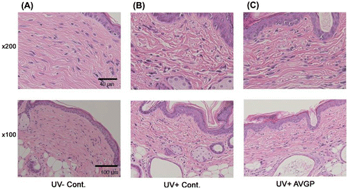 Fig. 3. Sections of hairless mouse dorsal skin tissue after 6 weeks of UVB irradiation, stained with H&E (original magnification × 200 and 100).