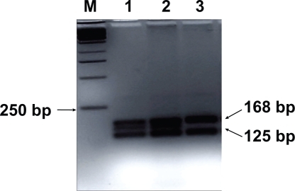 Figure 1 RFLP for CYP3A5. Lane M, base pair marker (250-bp DNA ladder); lanes 1–3, SspI-digested PCR products from three PCR products. CYP3A5*3/*3 genotype gives 168- and 125-bp bands (lane 3) and CYP3A5*1/*3 genotype gives 168-, 148-, 125-, and 20-bp (lanes 1 and 2). The 20-bp band is not visible. CYP3A5*1/*1 genotype is not seen in this picture. Analysis on a 3.5% agarose/Tris-borate-EDTA gel.