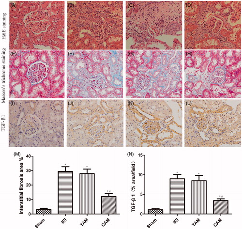 Figure 2. Metformin attenuated tissue damage, fibrogenic development, and TGF-β1 expression during I/R. (A, E, and I) Section from sham-operated rat, (B, F, and J) section from rat subjected to IRI, (C, G, and K) section from rat subjected to transient administration of metformin. (D, H, and L) section from rat subjected to continuous administration of metformin. (A–D) H&E staining. (E–H) Masson’s trichrome staining. (I–L) TGF-β1 immunohistochemical staining. All H&E, Masson’s trichrome staining and immunohistochemical staining, original magnification ×400. (M) Quantitative analysis of tubulointerstitial fibrosis. (N) Quantification of TGF-β1-positive cells. (*p < 0.05 versus the sham group, #p < 0.05 versus the IRI group. n = 5).