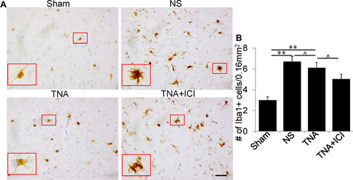 Figure 2 TNA treatment changed microglial morphology with no change in microglial numbers. (A) In Sham group some normal microglia with small cell body and long, thin branches. Compared to the microglia in Sham group there were more microglia with larger cell body and shorter, thick processes in mice treated with NS. TNA treatment obviously decreased the branches of microglia than in mice treated with NS or treated with TNA+ICI. Compared to microglia in NS-treated mice TNA+ICI treatment did not change activated microglia induced by TBI. A higher magnification picture was inserted for the red box in each picture. (B) Statistic analysis of microglial numbers (**P<0.01, ^P>0.05). (scale bar: 100 μm.).