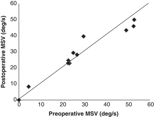 Figure 1. Results of caloric testing before and after EAS implantations in the implanted ear. There were no significant differences between preoperative and postoperative results (p = 0.67). MSV, maximum slow eye velocity.