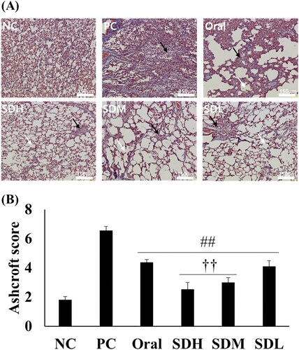 Figure 8. Histological evaluation of lungs with bleomycin-induced idiopathic pulmonary fibrosis in rats after drug administration (n = 5, mean ± standard error). (A) Microscopic image of lung section stained with trichrome. White arrow: broken alveolar wall; Black arrow: fibrosis mass (B) Ashcroft score of microscopic analysis. ## ANOVA, p-value < 0.005 compared with PC; †† ANOVA, p-value < 0.005 compared with Oral.