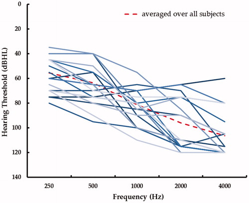 Figure 1. The hearing thresholds of the individual participants for the ear with the hearing aid. The dashed line displays the mean hearing loss averaged over all participants.