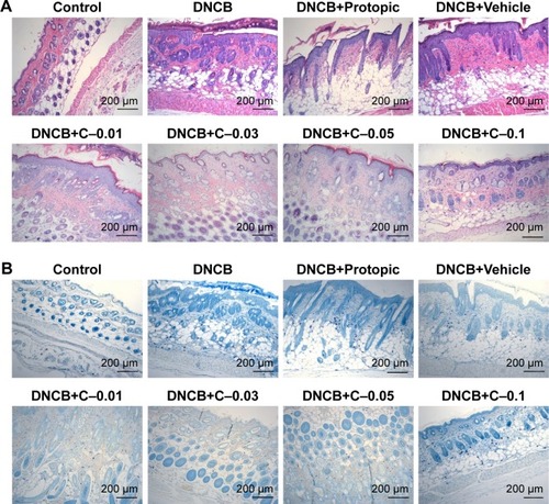 Figure 6 Histological features of skin after treatment with different formulations in the AD mouse model. The sliced sections were stained with hematoxylin and eosin (A) and toluidine blue (B) (magnification 100×). Scale bar: 200 μm.Abbreviations: AD, atopic dermatitis; C–0.01, FK506–NIC-CS-NPs containing 20% (w/v) NIC and 0.01% (w/v) FK506; C–0.03, FK506–NIC-CS-NPs containing 20% (w/v) NIC and 0.03% (w/v) FK506; C–0.05, FK506–NIC-CS-NPs containing 20% (w/v) NIC and 0.05% (w/v) FK506; C–0.1, FK506–NIC-CS-NPs containing 20% (w/v) NIC and 0.1% (w/v) FK506; DNCB, 1-chloro-2,4-dinitrobenzene; FK506, tacrolimus; FK506–NIC-CS-NPs, tacrolimus-loaded chitosan nanoparticles containing nicotinamide; NIC, nicotinamide.