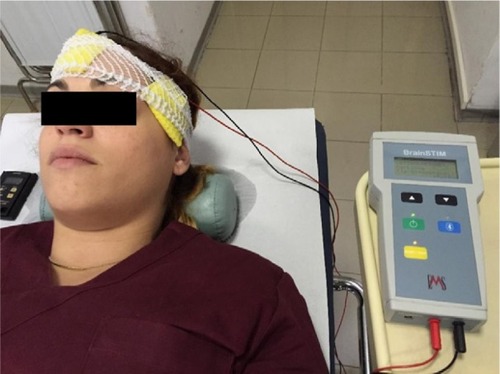 Figure 1 Photograph taken during T3 anodal transcranial direct current stimulation (tDCS) in a representative subject.