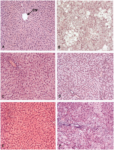Figure 3. Haematoxylin/eosin staining of representative liver sections from: (A) normal control rats administered vehicle (VE + VCT); (B) damaged control rats administered CT (VE + CT); (C) control rats administered Bocfal EO (Bocfal EO + VCT); (D) damaged rats administered Bocfal EO (Bocfal EO + CT); (E) control rats administered DADS (DADS + VCT) and (F) damaged rats administered DADS (DADS + CT). Central vein (CV), original magnification: 10×.