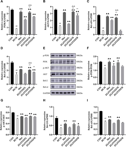 Figure 8 The expression levels of PI3K-AKT pathway molecules and apoptosis-related molecules in mouse myocardial tissues were quantitated. (A–D) The mRNA levels of PI3K (A), AKT (B), Bcl-2 (C), and Bcl-xL (D) in mouse myocardial tissues of the indicated groups were quantitated by qPCR. n=6 for each group; ##P<0.01, Compared with the CON group; ▲▲P<0.01, compared with the DCM group; **P<0.01, compared with the ZGJTSXFL group; ΔΔP<0.01, compared with the ZGJTSXFH group. (E–I) The protein levels of phosphorylated PI3K (p-PI3K; (F), phosphorylated AKT (p-AKT; (G), Bcl-2 (H), and Bcl-xL (I) in mouse myocardial tissues of the indicated groups were quantitated by Western blot assay. Representative images of Western blot bands are shown (E), and the relative expressions were summarized. n=6 for each group; ##P<0.01, compared with the CON group; n=6 for each group; ▲▲P<0.01, ▲P<0.05, compared with the DCM group.